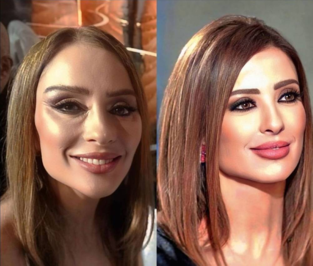 وفاء الكيلاني تثير الجدل بتغيير ملامحها في أحدث ظهور