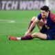 إصابة ليفاندوفسكي وغيابه عن كلاسيكو برشلونة وريال مدريد