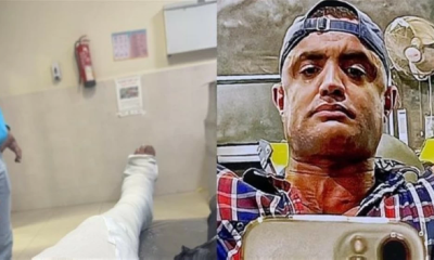 إصابة أحمد رمزي في مسلسل الكينج: تفاصيل الجراحة واستبعاده