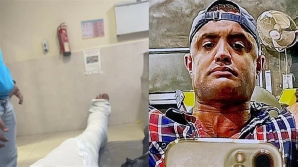 إصابة أحمد رمزي في مسلسل الكينج: تفاصيل الجراحة واستبعاده